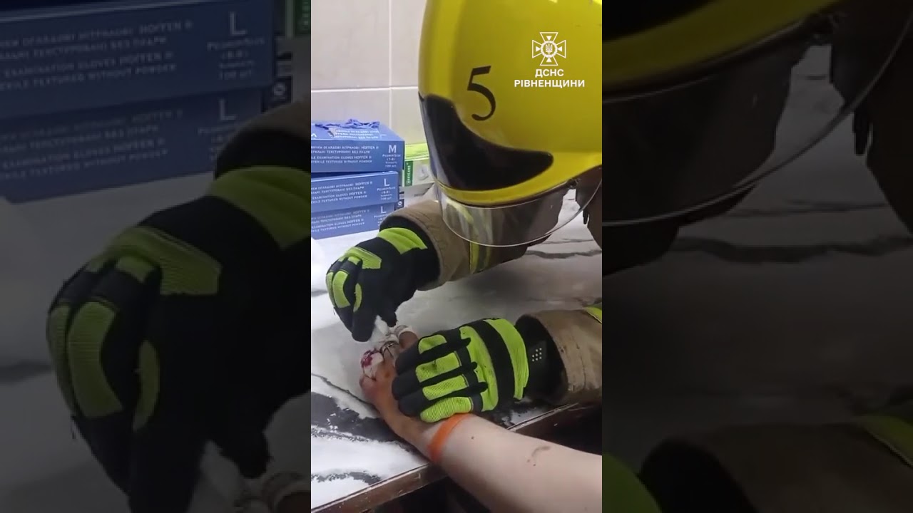 Хірургічна точність: на Рівненщині рятувальники вивільнити палець підлітка із металевої «пастки»